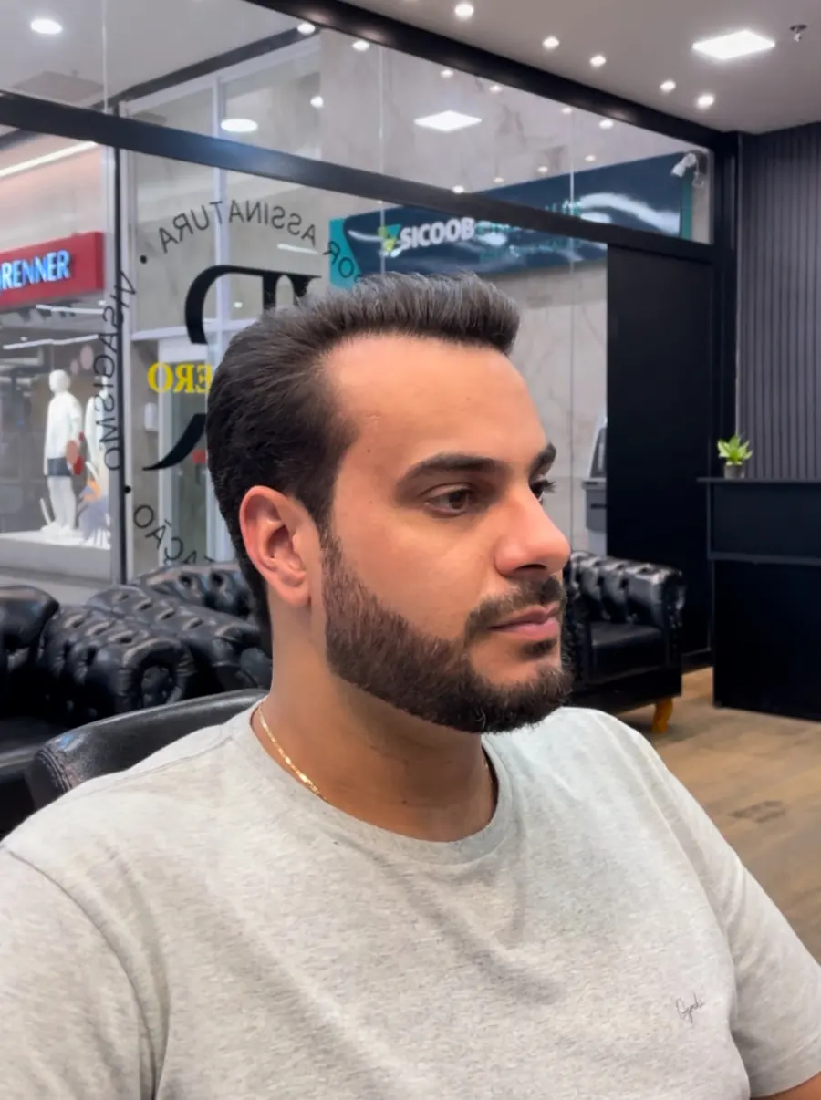 O mesmo cliente depois, com barba cheia desenhada e o cabelo penteado para trás